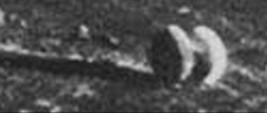 Lunik 13: Oceanus Procellarum (4)
...(una modesta depressione del terreno, ricolma di polvere) proprio davanti al Lander (frame 2). Per quanto attiene i 2 splendidi detail mgnf che Fabio Italiano ci ha messo davanti, il discorso diventa complesso. 
Questo non vuol dire che non intendiamo esprimerci, si badi: il problema è che abbiamo veramente pochissimi dati fra le mani e le immagini sono enigmatiche al punto da lasciarci spazi interpretativi così ampi che, alla fine, il rischio che si corre è quello di dire delle enormi stupidaggini. Comunque sia, ci affidiamo alla nostra (modesta) esperienza e (speriamo notevole) sensibilità. 
A nostro parere, questa prima Anomalìa non è, in realtà, un'Anomalìa, bensì un boulder dalla forma bizzarra. L'oggetto (che collocheremmo ad un 8/10 mt dal Lander), ci ricorda le pseudo-rocce Marziane ma, nello specifico, diremmo che si potrebbe trattare di una coppia di macigni (a forma di geode) molto vicini (sovrapposti, in parte, dall'angolo visuale del Lander) e, forse, divisi da un'altra roccia più piccola.
Parole chiave: Controversial frame