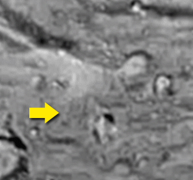 A "New Door" on Tethys...
...Ho isolato il particolare indicando con una freccia il GDU (Gravity Disk Unit). Il nome viene dal fatto che la sfera "nascente" dal GDU di solito si sposta ad una certa altezza dalla superficie, accompagnata da una specie di vortice pseudoconico semitrasparente, simile ad un fenomeno atmosferico di tipo ciclonico. Nell'animazione (ripresa da due distinte immagini Cassini) si vede abbastanza bene, a patto di guardare con attenzione per un paio di minuti.
Noterete come la sfera, inizialmente un po' più in alto della punta della freccia sulla destra, sembri spostarsi poi verso sinistra fino a toccare il piccolo cratere sopra la punta della freccia. Nella 3D si vede come il vortice si sia spostato con la sfera, in quanto noterai come l'immagine RED sia distanziata di molto da quella BLUE, indice certo di movimento relativo.
Vista la risoluzione della foto (il mio cellulare fotografa meglio) non posso certo pretendere di trarne conclusioni scientifiche precise, ma il fenomeno non mi è affatto nuovo, anzi a dire la verità l'ho riscontrato decine di volte anche nelle foto di Marte (e non solo).

Che i GDU siano delle specie di "porte" mi pare ormai abbastanza chiaro. Resta l'incertezza su cosa ci sia dall'altra parte...

Parole chiave: Investigations