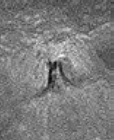 The Lobachevsky Anomaly, from Clementine (2) - detail mgnf
nessun commento
Parole chiave: The Lobachevsky Anomaly