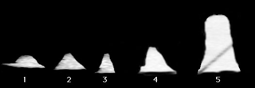 The "Blair Cuspids": possible shapes and visual appearance from Lunar datum (2)
These profile images are really negative images of the shadows of the 5 objects indicated by the numbers in the previous frame. The background has been blacked out by hand to emphasize the overall shape of each object. The shadows have been compressed in the direction of their length, according to the trigonometric relationship between an object's height (-->H), the length of its shadow (-->Ls), and the tangent of the Sun's elevation angle (-->A), above the surface on which the shadow falls. This relationship is: H = Ls tan(A).

Because the first four Cuspids appear to be situated on a fairly horizontal surface, the value of angle A was taken from the NASA support data to be the Sun's elevation above the horizon - 10,9° - and the images of the shadows were compressed by the value of that angle's tangent, such as 0,193°. 
A greater compression, corresponding to a Sun angle of 8° (tan(8) = 0,14) was used for the profile of Cuspid 5 because its shadow falls over the surface of the rectangular "trench", which is sloping downward away from the Sun, thus effectively decreasing the Sun's elevation above the surface. (…) 
The detailed contours of the objects are lost in these profiles due to the irregularities of the lunar surface and due to the blurring caused by the image compression algorithm. However, the general shapes of all the objects – except the first – can still be clearly seen to differ radically from the shapes of common lunar boulders and ridges. 
The profiles suggest that Cuspids 2 through 5 have heights greater than their widths, which would be a very unstable placement for a randomly placed boulder and even more unusual for a cluster of them. 
The hills and ridges of the Moon tend to be very low and rounded. The great lunar mountain Pico Mons in Mare Imbrium, for example, has a height only 16% of its width. 
Cuspids 2 though 4 are conical or pyramidal, while Cuspid 5 (still the tallest even with a lower Sun angle assumed) appears to be a cylinder. Based on the assumption that the sun's elevation is 8°  above the slope on which Cuspid 5's shadow is being cast, the object itself would have a height of approximately 15 meters. (…)

Parole chiave: The Blair Cuspids