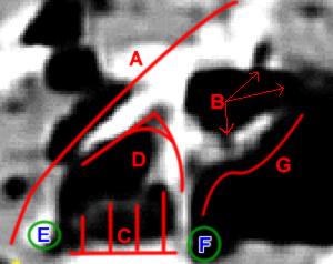 Skull-Rock: pseudo-rock or pseudo-fossil? (5) - from Sol 44
A - Traccia della lunghezza della parete frontale dell'Anomalìa;

B - Traccia della zona che considero l'orbita dell'occhio: ha una forma leggermente allungata verso Sx e finisce quasi a punta. Nel tratto superiore e inferiore, sono presenti due infossature (vedi freccette);

C - Traccia della "sospensione da terra della parte frontale dell'Anomalìa";
si vede distintamente la luce passare;

D - Traccia della curvatura della parte frontale dell'Anomalìa. Potrebbe essere paragonabile alla curvatura che va dal nostro naso allo zigomo.

E/F - Sono le 2 porzioni dell'Anomalìa che poggiano al suolo come farebbe un treppiedi e che ne sostengono la porzione frontale, mantenendola sollevata dal suolo;

G - Traccia della zona dell'Anomalìa paragonabile alla nostra area sub-orbitale e zigomatica.
Parole chiave: Controversial Mars' Surface Features