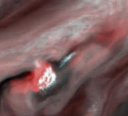 Water clouds on Jupiter
This false-color picture of a convective thunderstorm 10.000 Km(6.218 miles) northwest of Jupiter's Great Red Spot was obtained by NASA's Galileo spacecraft on June 26, 1996. The white cloud in the center is a tall, thick cloud about 1.000 Km (620 miles) across, standing 25 Km (15 miles) higher than most of the surrounding clouds. Its base extends off to the left and appears red in this representation. This red color indicates that the cloud base is very deep in the atmosphere, about 50 Km (30 miles) below the surrounding clouds. Most of the wisps and features in Jupiter's clouds are thick and thin ammonia clouds, forming at a pressure just less than Earth's sea level pressure. On Jupiter, water is the only substance to form a cloud at a depth where the pressure is about 5 times the Earth's sea level pressure. The red base of this thunderstorm is so deep that it can only be a water cloud. In 1979 NASA's Voyager spacecraft saw convective clouds of this type near the Great Red Spot. They erupted like this roughly once every 10 days and lasted a few days each. But Voyager's cameras could not allow the determination of the storms' altitude. It is thought that this storm is analogous to an Earth thunderstorm, with the cloud's high, bright, white portion comparable to the familiar anvil cloud on Earth. Whether any rain or snow is falling below this cloud is unknown, but there are indications that similar storms on Jupiter have lightning in them. 
Parole chiave: Jupiter from Galileo