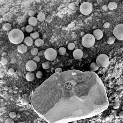 After the removal of a "Berry" (1 - context image) - Sol 1103
Sulla pietra (supponiamo di dimensioni non superiori ai 2 cm) che viene inquadrata dal Microscopic Imager del Rover Opportunity si vede molto bene qualcosa che ha tutte le sembianze di una sorta di cicatrice. Una cicatrice circolare.

Di che si tratta? A nostro parere si tratta di quello che rimane allorchè viene forzosamente rimosso un "berry" dalla superficie su cui esso aderiva in origine. Ricordate la Classificazione Generale dei Martian Berries? Ecco la nostra "casistica":

1) sferule "libere" (giacciono semplicemente appoggiate al suolo o ad altri rilievi);
2) sferule "vincolate" (costituiscono parte integrante del suolo o di rocce quali i Pavimenti Marziani);
3) sferule "vincolate con peduncolo" (sono attaccate a delle rocce tramite una specie di gambo o bastoncello).
4) granuli: leggermente diversi dalle sferule, sono molto più compatti (come "accatastati" gli uni sugli altri) ed hanno forme e dimensioni variabili.

Attenzione: quando abbiamo detto "forzosamente" rimosso non intendevamo alludere ad una attività manipolatoria posta in essere dal Rover. La "sferula" si può essere staccata dalla pietra per tantissimi motivi, incluse le azioni del Rover ma non solo.
Ciò che conta è aver notato che, post rimozione/distacco (comunque causato) di una sferula dalla sua posizione originaria, rimane una "cicatrice" sulla superficie che la ospitava.

Andiamo ora a vedere la tessitura della "cicatrice"...
Parole chiave: Microscopic Imager - Martian Berries - Controversial
