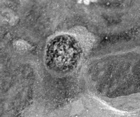 After the removal of a "Berry" (2 - extra-detail mgnf) - Sol 1102
L'ingrandimento che Vi proponiamo è (a nostro parere) piuttosto buono, ma ancora lontano dall'essere definitivamente illuminante: quello che si vede è una superficie a matrice granulare, piena di spazi vuoti (come delle "sacche" o dei "pori") e con al suo interno qualcosa che sembrano dei "filamenti" di colore chiaro, disposti a matassa nella porzione centrale del dettaglio.

La domanda, ovvia, è solo una: stiamo parlando del residuo di un rilievo avente natura "organica"? Ai posteri l'ardua sentenza...
Parole chiave: Microscopic Imager - Martian Berries - Controversial