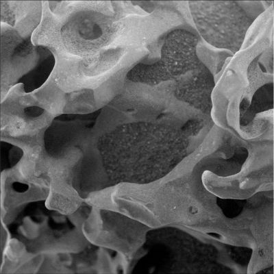 Third Strike! - Sol 736
Terzo strike di Lunar Explorer! Per la terza volta in pochissimi giorni, infatti, la NASA ha speso qualche parola per spiegare un frame sul quale ci eravamo soffermati anche noi, operando delle speculazioni. Come sempre, quello che la NASA dice è completamente diverso da quello che diciamo noi (ma non fa niente, anzi!...) e, come sempre, le spiegazioni NASA, seppur logicamente accettabili, secondo noi fanno a pugni con le evidenze delle quali disponiamo.
Ad ogni modo, noi siamo molto contenti e Vi rimandiamo a quello che ci viene raccontato da Pasadena: la teoria "più accettabile", decidetela - come sempre - Voi stessi!

Original caption:NASA's MER Spirit used its MI to capture this spectacular jagged mini-landscape on a rock called "GongGong" Measuring only 3 cm(about 1,2") across, this surface records two of the most important and violent forces in the history of Mars -- volcanoes and wind. 
GongGong formed billions of years ago in a seething, stirring mass of molten rock. It captured bubbles of gases that were trapped at great depth but had separated from the main body of lava as it rose to the surface. Like taffy being stretched and tumbled, the molten rock was deformed as it moved across an ancient Martian landscape. The tiny bubbles of gas were deformed as well, becoming elongated. When the molten lava solidified, the rock looked like a frozen sponge. 

Far from finished with its life, the rock then withstood billions of years of pelting by small sand grains carried by Martian dust storms that sometimes blanketed the planet. The sand wore away the surface until, little by little, the delicate strands that enclosed the bubbles of gas were breached and the spiny texture we see today emerged. 

Even now, wind continues to deposit sand and dust in the holes and crevices of the rock. 

Similar rocks can be found on Earth where the same complex interplay of volcanoes and weathering occur, whether it be the pelting of rocks by sand grains in the Mojave desert or by ice crystals in the frigid Antarctic. 

GongGong is one of a group of rocks studied by Spirit and informally named by the Athena Science Team to honor the Chinese New Year (the Year of the Dog). In Chinese mythology, GongGong was the god-king of water in the North Land. When he sacrificed his life to knock down Mount BuZhou, he defeated the bad Emperor in Heaven, freed the sun, moon and stars to go from east to west, and caused all the rivers in China to flow from west to east. 

Spirit's microscopic imager took this image during on the rover's 736th day, or sol, of exploring Mars (Jan. 28, 2006). The rock lies in the "Inner Basin" between "Husband Hill" and "McCool Hill" in Gusev Crater. Spirit acquired the image while the rock was fully shadowed, with diffuse illumination mostly from the top in this view.

Parole chiave: Microscopic Imager (MI) - Controversial Frame