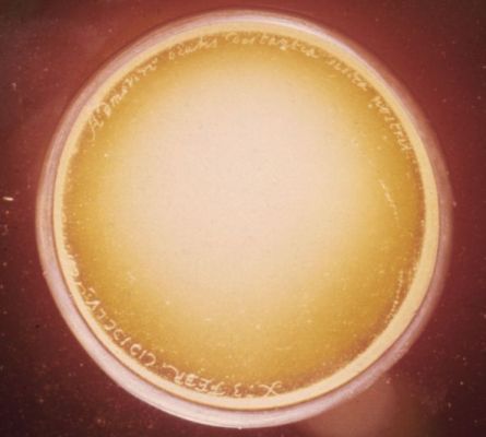 The Discovery of Titan
Il 25 Marzo 1655 l'Astronomo Olandese Christiaan Huygens scopriva "Luna Saturni" - ossìa Titano. In questo frame vediamo tutto ciò che resta del telescopio che egli usò (nota: telescopio concepito e costruito in collaborazione con suo fratello, Constantijn Huygens): la lente. Essa ha un diametro di 57 mm e reca sul bordo la dicitura "X 3 FEBR. MDCLV": si tratta della lunghezza focale e della data di completamento del lavoro (e cioè la "lucidatura" della lente stessa): il 3 February 1655. 
Si leggono altresì (in alto) questi versi di Ovidio, "Admovere Oculis Distantia Sidera Nostris". Un pizzico di romanticismo? No, solo la porzione di un anagramma: un semplice gioco enigmistico (molto comune ai suoi tempi) che riportava alcuni dettagli della sua scoperta (data inclusa). Decodificato e tradotto l'anagramma di Huygens recita "Una luna orbita intorno a Saturno in 16 giorni e 4 ore". Oggi sappiamo che il periodo orbitale di Titano è pari a poco meno di 16 giorni. Titano ha rallentato o Huygens sbagliò i conti?
Parole chiave: History of Science