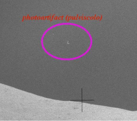 AS 16-106-17398 (HR) - Dust...again!
Ancora pulviscolo. Indeterminabile, invece, la natura dello Star-like Object che si vede ad ore 10 della Cerchiatura.
Parole chiave: Lunar Sky - Photoartifact and Star-like Object