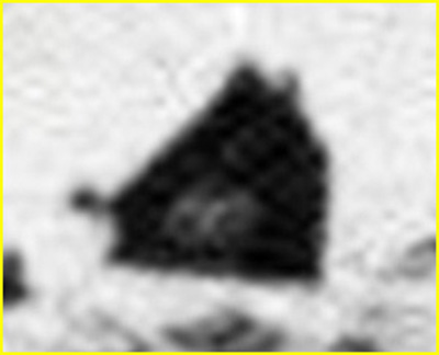 Home, sweet Home... - Sol 2141 (EDM n.2 - credits for the research and add. process.: Ivana Tognoloni - Lunexit Team)
Gli EDMs, ne siamo consapevoli, non risolvono i dubbi sulla natura dell'oggetto individuato dalla bravissima Ivana, anzi - e se possibile... - concorrono ad aumentarli! Tuttavia non ci sembra di "bestemmiare" allorchè diciamo che quanto ripreso dal MER Opportunity è, quanto meno, un "dettaglio superficiale bizzarro".
Una forma curiosa (squadrata), una profondità discutibile - e di fatto contraddetta dalle fattezze e dall'estensione (apparente) del rilievo - ed un oggetto più chiaro, posto proprio nel bel mezzo della chiazza scura, che sembra "sporgersi" ed osservare nella direzione del MER Opportunity che transita ad una trentina di metri di distanza.

Come abbiamo già scritto e come scriveremo ancora, ognuno può credere quello che vuole (purchè motivando), legittimamente, poichè la risposta definitiva verrà solo quando andremo in loco a verificare. Ma sino ad allora, sia detto con la massima Umiltà, cerchiamo di essere - almeno un minimo! - possibilisti.

Is there Life on Mars? Chi ha l'arroganza di poter dare, oggi, una risposta CERTA e DEFINITIVA? Pensateci sopra...
Parole chiave: Martian Surface - Controversial Frame