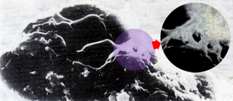 A slice of the Infinite beyond (7) - by Dr Alessio Feltri
In questa rarissima immagine degli anni ’70 potete vedere un minuscolo (un centesimo di millimetro) frammento dello strato di cui sopra, riportato a terra da un pallone sonda. Nell’ingrandimento ho evidenziato uno dei soliti intrecci fibrosi radiali, quelli che definisco convenzionalmente “sinaptici”.

Le malattie sono solo un aspetto dell’enigma virus e nemmeno il più importante. Dallo studio dei virus oncogeni sappiamo che questi ultimi in alcuni casi provocano un’incontrollata proliferazione cellulare, mentre in altre circostanze si limitano ad indurre modificazioni innocue nel DNA.

In altre parole il virus se non ti uccide, ti cambia. Si potrebbe essere anche tentati di considerarli un raffinato espediente per automatizzare il controllo della quantità e del comportamento della biomassa planetaria, un motore occulto dell’evoluzione. Fantascienza? Forse, ma pare che la questione sia proprio questa.

Tutta la faccenda è sempre stata coperta da rigoroso riserbo. Il cancro può sopravvenire per molti motivi, ma, dato che ognuno di noi è un portatore più o meno sano di retrovirus potenzialmente oncogeni, determinate informazioni, se diffuse ufficialmente, potrebbero causare fenomeni di allarme sociale, anche senza scomodare implicazioni teologiche o devianze ipotizzabili sull’onda del “dagli all’untore” di manzoniana memoria. Molto più prudente appellarsi a non precisate cause genetiche. Si dice la verità e contemporaneamente non si dice nulla. Esattamente come quando si dice che sulla Luna o su Marte non sono state ancora individuate forme di vita.

Forse vi sembrerà che io mi sia spinto un po’ troppo oltre, ma c’è chi ha fatto di peggio e non era una persona qualsiasi, era il massimo esperto mondiale di DNA, premio Nobel insieme a Watson per la scoperta della doppia elica, Francis Harry Compton Crick (1916-2004).
Parole chiave: Virus