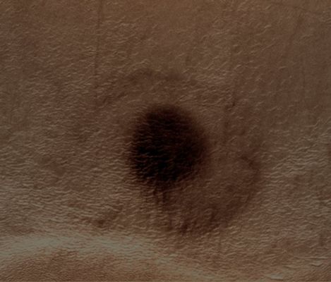 Extremely Unusual Surface Feature in Argyre Planitia (Natural Colors - SuperEDM n.3 - credits: Dr G. Barca & Lunexit)
A nostro parere, grazie a quest'ultimo EDM (ottenuto dal nostro grande Amico e Partner, Dr G. Barca), la natura della Surface Feature può essere accertata con un elevatissimo margine di sicurezza: si tratta della traccia di un impatto (sui generis).
Un impatto recentissimo, il quale ha visto la disintegrazione (probabilmente l'esplosione) del bolide negli immediati pressi del suolo (il che significa, in altre parole, che l'impatto, si, c'è stato, ma solo fra i detriti derivati dall'esplosione - con traccia della fiammata al suolo - ma SENZA una collisione vera e propria tra il bolide - che doveva essere piccolo e leggero - e la superficie).

Secondo noi, il "mistero" è risolto. Ma se Voi aveste opinioni in merito...scrivete!
Parole chiave: Mars from orbit - Argyre Planitia Region