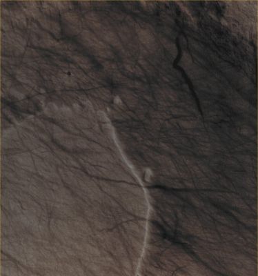 Dust Devils' Tracks in Noachis Terra (Natural Colors; credits for the additional process. and color.: Drr Gianluigi Barca and Paolo C. Fienga - Lunexit Team)
Mars Local Time: 14:28 (Early Afternoon)
Coord. (centered): 53,8° South Lat. and 357,1° East Long.
Spacecraft altitude: 253,0 Km (such as about 158,2 miles) 
Original image scale range: 25,3 cm/pixel (with 1 x 1 binning) so objects ~ 76 cm across are resolved 
Map projected scale: 25 cm/pixel
Map projection: EQUIRECTANGULAR
Emission Angle: 5,4° 
Sun-Mars-Spacecraft (or "Phase") Angle: 47,2°
Solar Incidence Angle: 43° (meaning that the Sun is about 47° above the Local Horizon)
Solar Longitude: 300,5° (Northern Winter)
Credits: NASA/JPL/University of Arizona
Additional process. and coloring: Drr Gianluigi Barca and Paolo C. Fienga - Lunar Explorer Italia
Parole chiave: Mars from orbit - Aeolian Features - Dust Devil Tracks (DD Tracks)