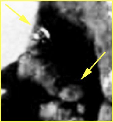Small-Face and a Snake-like Surface Feature near Spirit - Sol 485 (EDM n.1 - credits: Ivana Tognoloni - Lunexit Team)
nessun commento
Parole chiave: Martian Surface - Controversial