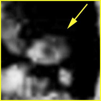 Small-Face and a Snake-like Surface Feature near Spirit - Sol 485 (EDM n.3 - credits: Ivana Tognoloni - Lunexit Team)
nessun commento
Parole chiave: Martian Surface - Controversial